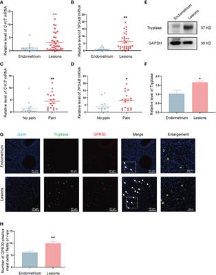 GPR30-mediated non-classic estrogen pathway in mast cells participates in endometriosis pain via the production of FGF2